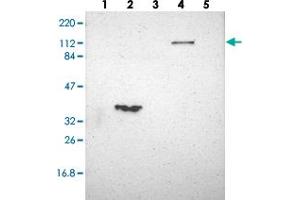 Western blot analysis of Lane 1: RT-4, Lane 2: U-251 MG, Lane 3: Human Plasma, Lane 4: Liver, Lane 5: Tonsil with FAM65A polyclonal antibody  at 1:250-1:500 dilution.