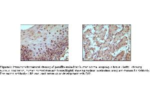 Image no. 1 for anti-Retinoblastoma Protein (Rb Protein) antibody (ABIN205594) (Retinoblastoma Protein (Rb) anticorps)