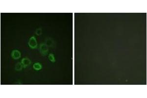 Immunofluorescence analysis of HuvEc cells, using Bax (Ab-167) Antibody. (BAX anticorps  (AA 133-182))