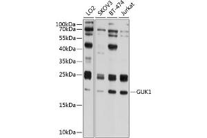 Western blot analysis of extracts of various cell lines, using GUK1 antibody (ABIN6133522, ABIN6141539, ABIN6141540 and ABIN6224743) at 1:1000 dilution.