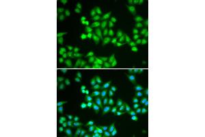 Immunofluorescence analysis of HeLa cells using CHD2 antibody. (CHD2 anticorps)