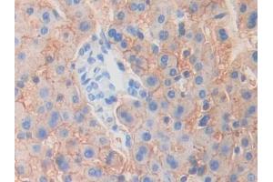 IHC-P analysis of Human Liver Tissue, with DAB staining. (MYO1G anticorps  (AA 769-1016))