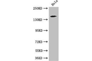 Western Blot Positive WB detected in: Hela whole cell lysate All lanes: TNRC6C antibody at 3. (TNRC6C anticorps  (AA 157-421))