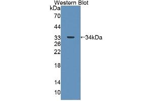 Detection of Recombinant ABAT, Mouse using Polyclonal Antibody to 4-Aminobutyrate Aminotransferase (ABAT)