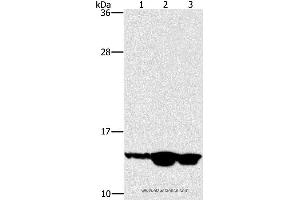 Western blot analysis of Mouse skin tissue, human fetal liver and fetal brain tissue, using HES5 Polyclonal Antibody at dilution of 1:100 (HES5 anticorps)
