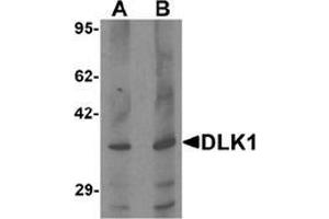 Western blot analysis of HepG2 in 293 cell lysate with DLK1 Antibody  at (A) 1 and (B) 2 μg/ml. (DLK1 anticorps  (C-Term))