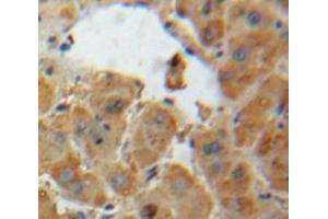 IHC-P analysis of Liver tissue, with DAB staining. (AGT anticorps  (AA 25-477))