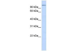 TXNDC16 antibody used at 1 ug/ml to detect target protein.