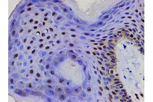 ABIN6267443 at 1/200 staining human skin tissue sections by IHC-P.