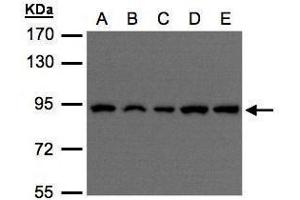 WB Image Sample(30 μg of whole cell lysate) A:H1299 B:HeLa S3 , C:Hep G2 , D:MOLT4 , E:Raji , 7. (VPS35 anticorps  (C-Term))