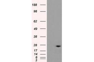 Western Blotting (WB) image for anti-Dicarbonyl/L-Xylulose Reductase (DCXR) antibody (ABIN1497787) (DCXR anticorps)