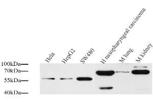 Western Blot analysis of various samples using CD54 Polyclonal Antibody at dilution of 1:1000. (ICAM1 anticorps)