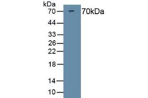 Detection of Recombinant HDAC1, Mouse using Polyclonal Antibody to Histone Deacetylase 1 (HDAC1) (HDAC1 anticorps  (AA 1-482))