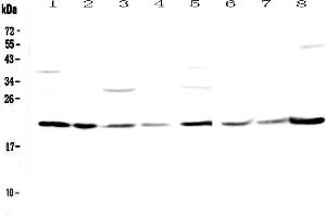 Western blot analysis of GLO1 using anti-GLO1 antibody .