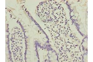 Immunohistochemistry of paraffin-embedded human small intestine tissue using ABIN7162226 at dilution of 1:100 (PLAC1L anticorps  (AA 74-158))