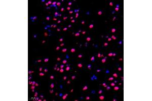 Immunofluorescence of paraffin embedded mouse brain using NAIF1 (ABIN7074867) at dilution of 1:650 (400x lens)