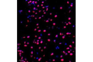 Immunofluorescence of paraffin embedded mouse brain using NAIF1 (ABIN7074867) at dilution of 1:650 (400x lens) (NAIF1 anticorps)