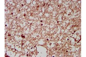 IHC image of ABIN7161362 diluted at 1:200 and staining in paraffin-embedded human brain tissue performed on a Leica BondTM system. (NrCAM anticorps  (AA 1194-1299))