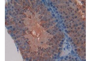 Detection of TFAM in Mouse Testis Tissue using Polyclonal Antibody to Transcription Factor A, Mitochondrial (TFAM)
