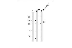 Lane 1: C6, Lane 2: HeLa, Lane 3: mouse cerebellum lysate at 20 µg per lane, probed with bsm-51197M PIp1 (538CT16.