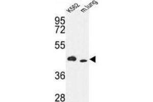 Western Blotting (WB) image for anti-Inositol-Trisphosphate 3-Kinase A (ITPKA) antibody (ABIN3003733) (ITPKA anticorps)