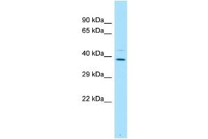 WB Suggested Anti-PLSCR4 Antibody Titration: 1. (PLSCR4 anticorps  (C-Term))