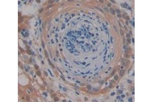 IHC-P analysis of Kidney tissue, with DAB staining. (MEK2 anticorps  (AA 86-331))