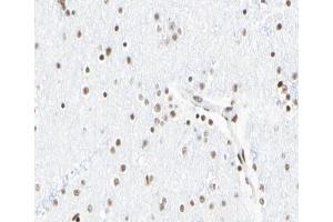 ABIN6267065 at 1/100 staining human Brain tissue sections by IHC-P. (Histone 3 anticorps  (H3K18ac))