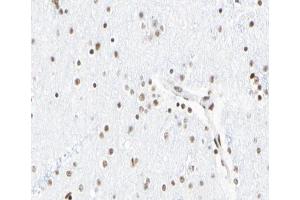 ABIN6267065 at 1/100 staining human Brain tissue sections by IHC-P.