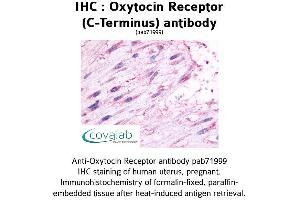 Image no. 1 for anti-Oxytocin Receptor (OXTR) (C-Term), (Cytoplasmic Domain) antibody (ABIN1737738) (Oxytocin Receptor anticorps  (C-Term, Cytoplasmic Domain))