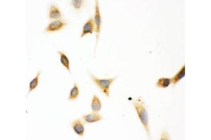 IHC analysis of ASPH using anti-ASPH antibody (ABIN3043790). (Aspartate beta Hydroxylase anticorps  (C-Term))