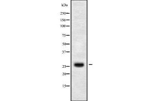 Western blot analysis of CLDN14 using HuvEc whole cell lysates (CLDN14 anticorps  (C-Term))