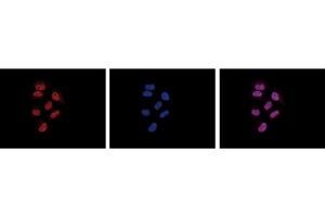 Immunofluorescence Microscopy of anti-Pol II antibody Immunofluorescence Microscopy results of Mouse anti-Pol II antibody. (POLR2A/RPB1 anticorps)