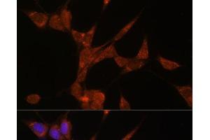 Immunofluorescence analysis of NIH/3T3 cells using AKR1C3 Polyclonal Antibody at dilution of 1:100. (AKR1C3 anticorps)