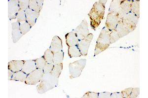 Anti- CPT1B Picoband antibody, IHC(P) IHC(P): Mouse Skeletal Muscle Tissue (CPT1B anticorps  (N-Term))