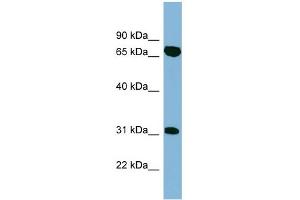 WB Suggested Anti-HIRIP3 Antibody Titration: 0. (HIRIP3 anticorps  (Middle Region))
