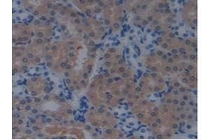 Detection of PDCD6IP in Mouse Kidney Tissue using Polyclonal Antibody to Programmed Cell Death Protein 6 Interacting Protein (PDCD6IP) (ALIX anticorps  (AA 1-239))