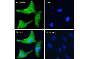 ABIN6391351 Immunofluorescence analysis of paraformaldehyde fixed HeLa cells, permeabilized with 0. (TRPC1 anticorps  (Internal Region))