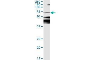 Immunoprecipitation of CAMKK2 transfected lysate using anti-CAMKK2 monoclonal antibody and Protein A Magnetic Bead , and immunoblotted with CAMKK2 MaxPab rabbit polyclonal antibody.