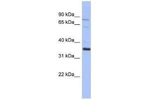 WB Suggested Anti-NRBP2 Antibody Titration: 0. (NRBP2 anticorps  (Middle Region))