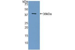 Western blot analysis of recombinant Human MBP. (MBP anticorps  (AA 135-190))