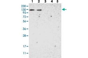 ADNP2 antibody
