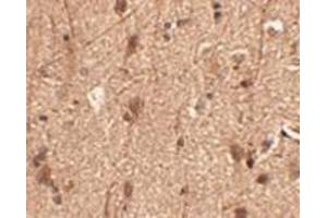 Immunohistochemistry of Slitrk3 in human brain tissue with AP30802PU-N Slitrk3 antibody at 2. (SLITRK3 anticorps  (C-Term))