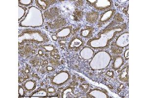 IHC analysis of ERLIN2 using anti-ERLIN2 antibody (ABIN7602582). (ERLIN2 anticorps  (AA 87-339))