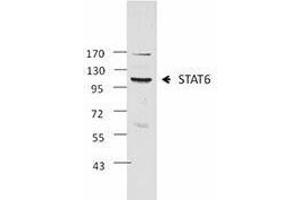 Western Blotting (WB) image for anti-Signal Transducer and Activator of Transcription 6, Interleukin-4 Induced (STAT6) antibody (ABIN2666296) (STAT6 anticorps)