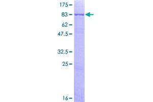 Image no. 2 for Nemo-Like Kinase (NLK) (AA 1-515) protein (GST tag) (ABIN1312656)