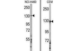 Western Blotting (WB) image for anti-Ubiquitination Factor E4A (UBE4A) antibody (ABIN3001447) (UBE4A anticorps)