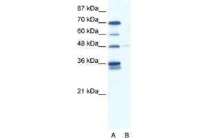Western Blotting (WB) image for anti-GLIS Family Zinc Finger 2 (GLIS2) antibody (ABIN2460153) (GLIS2 anticorps)