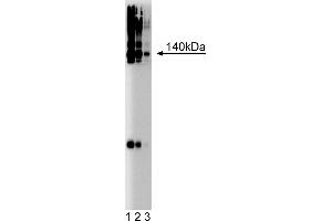 Western Blotting (WB) image for anti-Brevican (BCAN) (AA 232-394) antibody (ABIN968236) (BCAN anticorps  (AA 232-394))