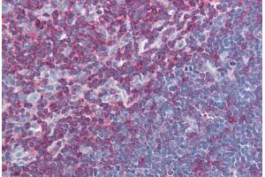 Human Thymus (formalin-fixed, paraffin-embedded) stained with LCP2 antibody ABIN239827 at 10 ug/ml followed by biotinylated anti-mouse IgG secondary antibody ABIN481714, alkaline phosphatase-streptavidin and chromogen. (LCP2 anticorps  (AA 216-434))